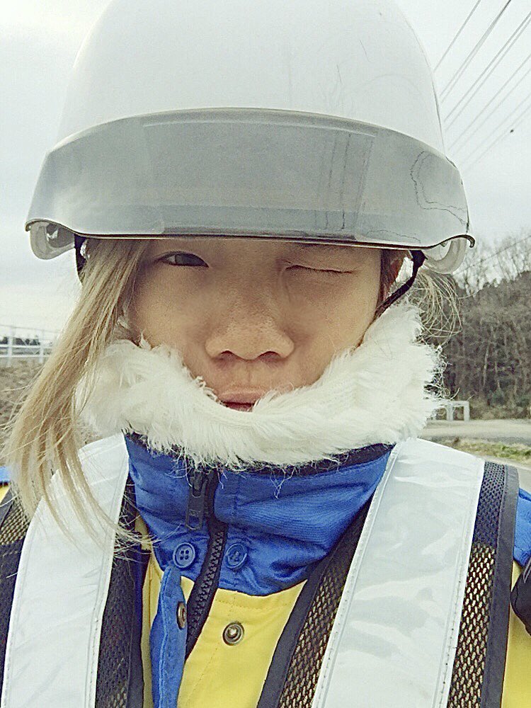 Cô gái "vịt hóa thiên nga" sau khi chi 4 tỷ cho hơn 20 cuộc phẫu thuật, nhan sắc trước và sau thẩm mỹ khó tin nổi - 2